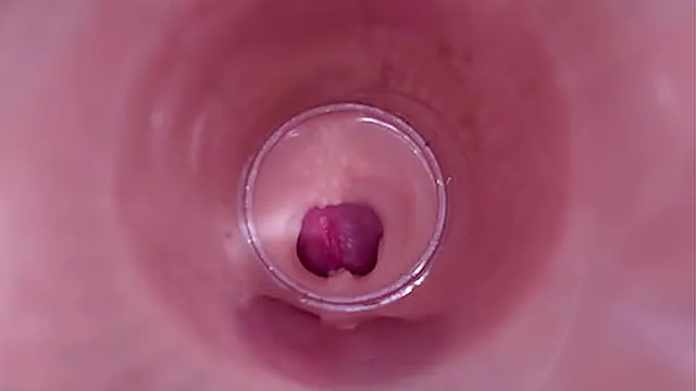 Female Insemination - Internal Camera Captures Deep Male Ejaculation